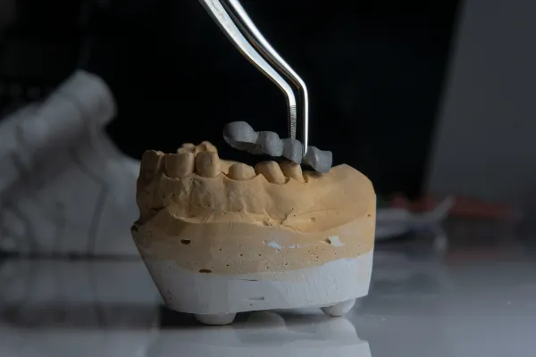 Gum Disease Treatment